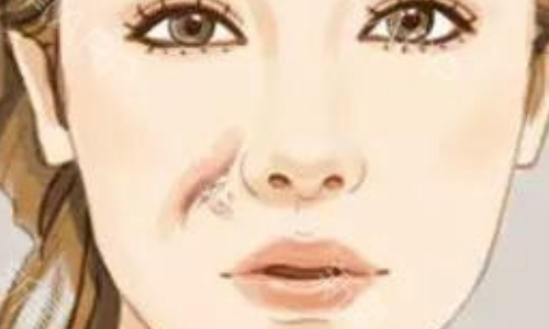 無錫兒童醫(yī)院美容科祛疤怎么樣？疤痕修復(fù)案例效果反饋&坐診醫(yī)生