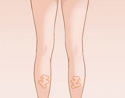 河北省人民醫(yī)院整形外科怎么樣？醫(yī)院信息資料+案例查收