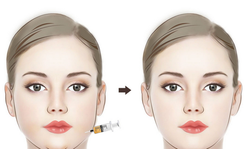 溫州市中西醫(yī)結合醫(yī)院醫(yī)學美容中心抽脂靠譜嗎？技術水平和簡介解析