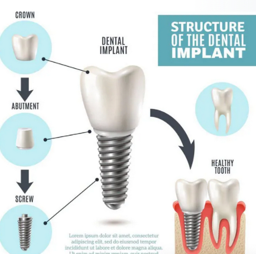 云南省口腔醫(yī)院種植牙哪個醫(yī)生好？李自良、張舒、謝亮焜口碑點評