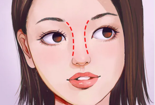 北京葉美人醫(yī)療美容隆鼻怎么樣？鼻子做的自然又好看！