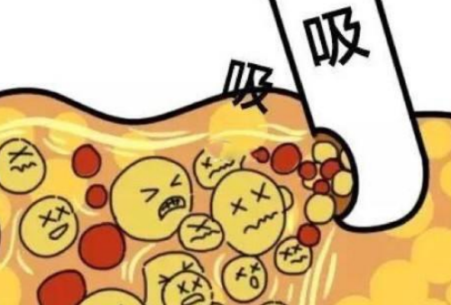 廣州韓妃吸脂怎么樣？收費(fèi)明細(xì)及醫(yī)院信息匯總