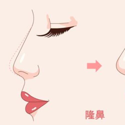 中山禾佳醫(yī)療美容隆鼻價(jià)格公布~醫(yī)院資料及收費(fèi)標(biāo)準(zhǔn)附上