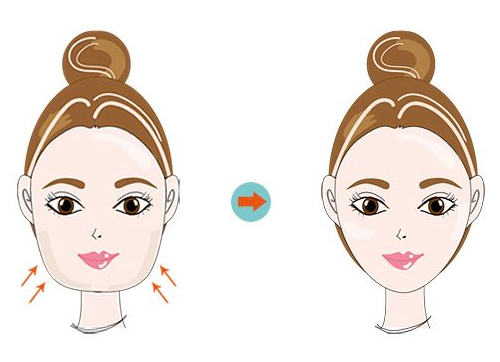 貴陽利美康整形醫(yī)院吸脂多少錢？醫(yī)院實力介紹和案例反饋