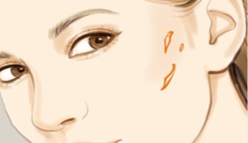 鄭州大學(xué)第一附屬醫(yī)院去疤痕多少錢？醫(yī)院介紹+案例分享