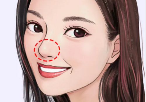 北京中西醫(yī)結(jié)合醫(yī)院整形科隆鼻價(jià)格|術(shù)后案例參考及醫(yī)院資料