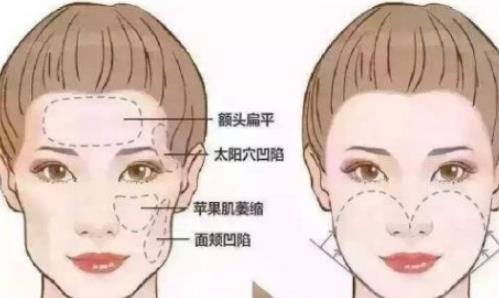 上海鵬愛醫(yī)療美容門診部玻尿酸除皺多少錢？體驗感受及醫(yī)院實力詳解