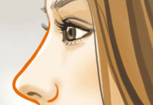 上海市同濟(jì)醫(yī)院整形科怎么樣？雙眼皮案例分享+收費(fèi)標(biāo)準(zhǔn)