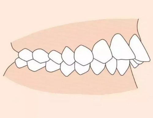 菏澤雅康口腔牙齒矯正多少錢？醫(yī)院實力、案例詳情盤點