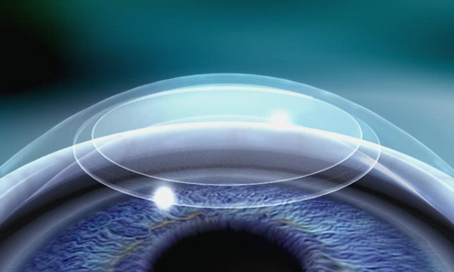 flex01.jpg flex01.jpg