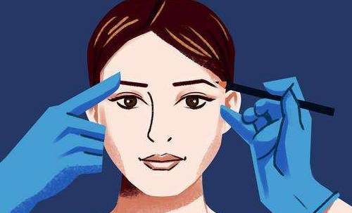 浙江綠城醫(yī)院整形美容雙眼皮做的怎么樣？一起來看新真人案例分享