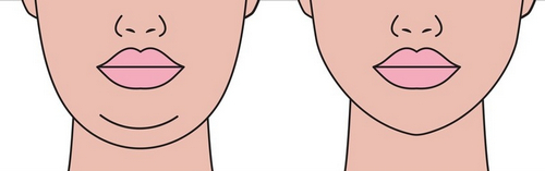 廣州軍美醫(yī)療美容醫(yī)院吸脂怎么樣？想要精致臉型快來抄作業(yè)