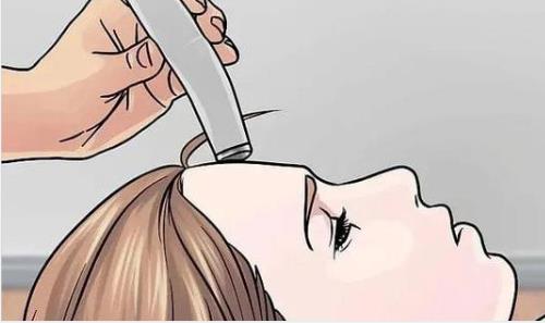 洛陽佰麗醫(yī)療美容醫(yī)院去皺紋怎么樣？費(fèi)用參考及案例反饋