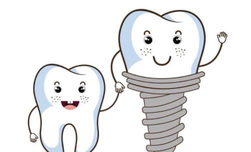 上海偉德口腔門診部種植牙價格多少？案例口碑和費用明細公開