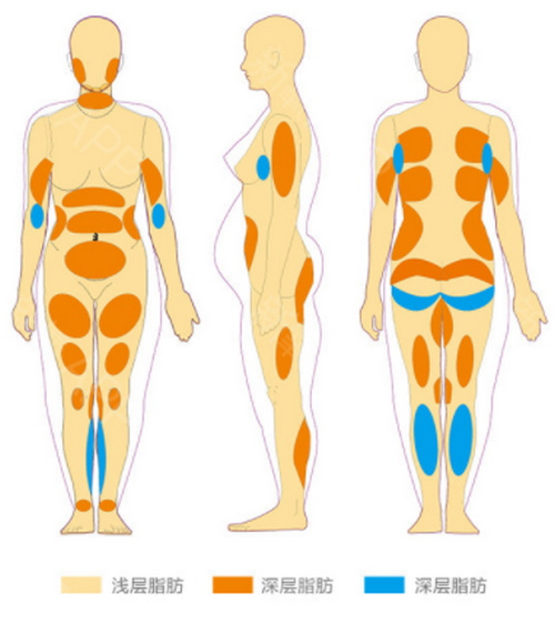 北京大學(xué)人民醫(yī)院醫(yī)學(xué)美容科吸脂怎么樣？相關(guān)案例曝光，絕了，一定要入手