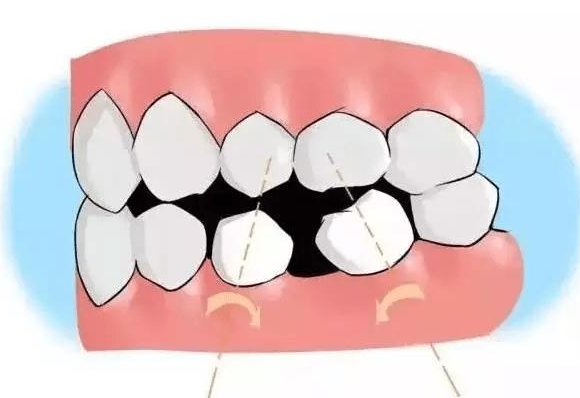 廈門麥芽口腔醫(yī)院牙齒矯正怎么樣?案例發(fā)布,正畸后的效果太棒了