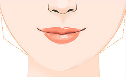 北京八大處楊斌擅長什么手術(shù)？下頜骨整形技術(shù)好嗎？附面部輪廓整形案例