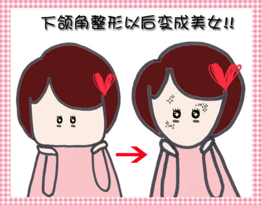 青島亞美整形美容醫(yī)院整形科顴骨整形好不好？技術(shù)水平和簡(jiǎn)介解析