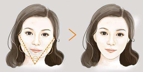 南昌大學(xué)第一附屬醫(yī)院整形美容科下頜角整形技術(shù)怎么樣？機(jī)構(gòu)資質(zhì)+醫(yī)生手術(shù)案例分享