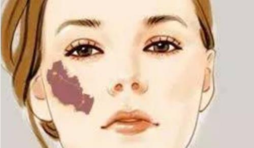 郴州市第一人民醫(yī)院祛斑多少錢？案例效果反饋，醫(yī)院簡介