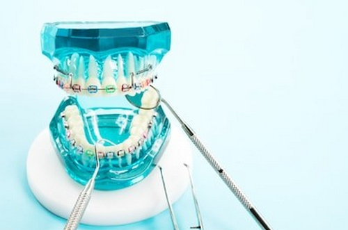 徐州醫(yī)學(xué)院附屬淮海醫(yī)院口腔科牙齒矯正好嗎？正畸案例評價(jià)+醫(yī)生介紹