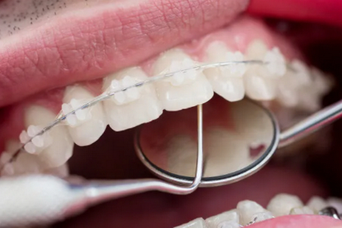 安徽省立醫(yī)院口腔科牙齒矯正怎么樣？2024價格表詳情+詳細(xì)醫(yī)院信息