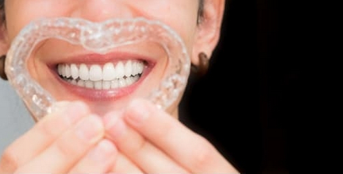 廊坊市人民醫(yī)院牙齒矯正大概需要多少錢?正畸案例及醫(yī)院優(yōu)勢(shì)盤點(diǎn)