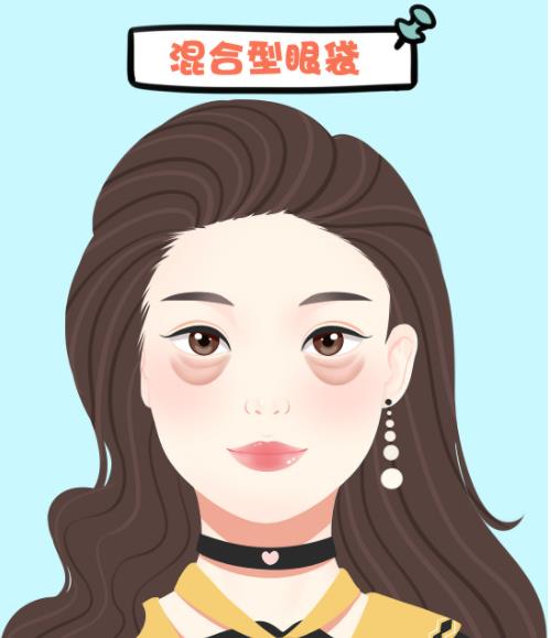 長沙伊臣醫(yī)療美容門診部全切眼袋怎么樣? 醫(yī)院簡介/手術案例公布