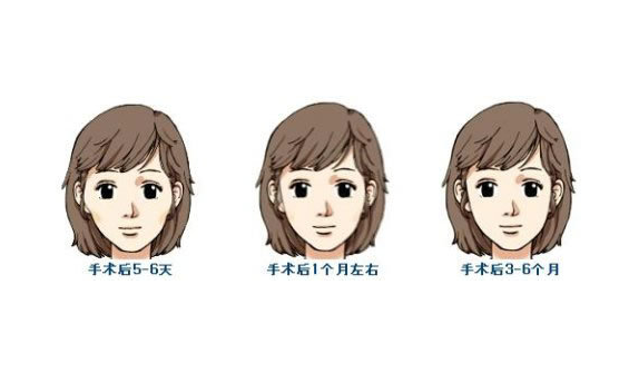 江蘇省沭陽縣人民醫(yī)院燒傷外科醫(yī)生技術(shù)詳細(xì)介紹一覽！內(nèi)附案例分享