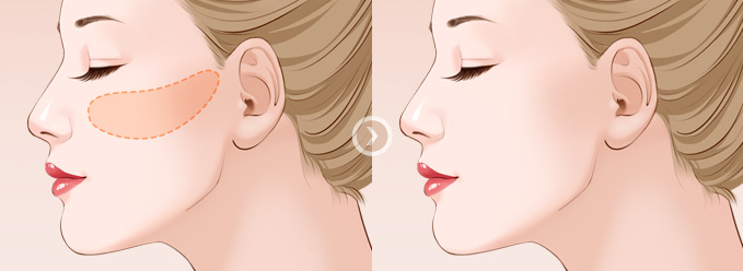 江蘇大學(xué)附屬醫(yī)院整形美容科醫(yī)生技術(shù)好不好？附帶醫(yī)院詳細、真人案例反饋！