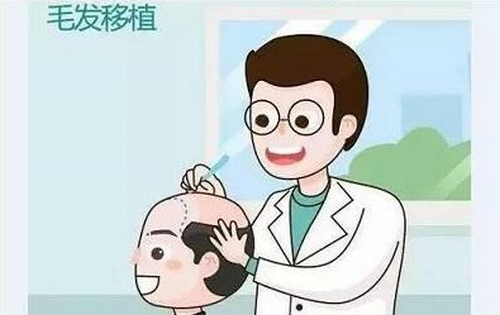 青醫(yī)附院整形美容科植發(fā)多少錢(qián)？一起來(lái)看植發(fā)案例分享