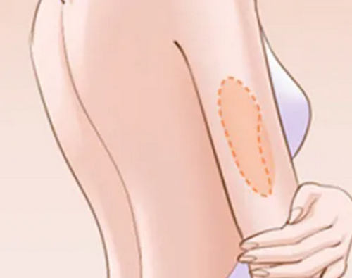 杭州藝星整形醫(yī)院吸脂技術(shù)怎么樣？修復(fù)反饋怎么樣？醫(yī)院介紹價(jià)格透明