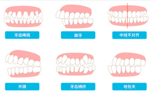 保定市第二醫(yī)院口腔科牙齒矯正怎么樣？詳細(xì)案例分享+價格表參考