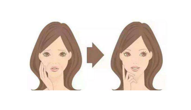 哈爾濱穆斯林醫(yī)院整形科，注射除皺真人案例