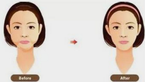 常德市第一人民醫(yī)院整形科抽脂怎么樣？醫(yī)生推薦+案例參考