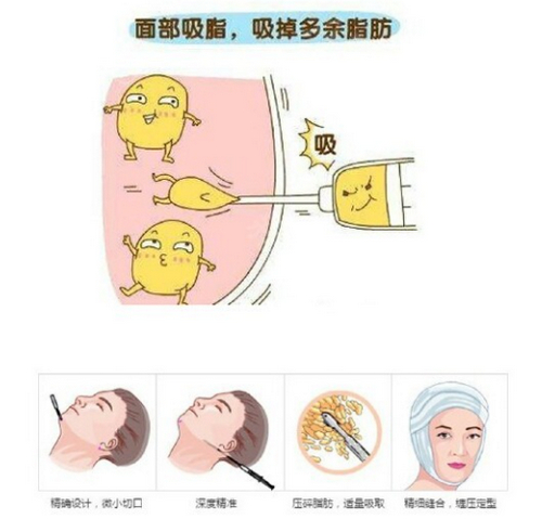 北京伊美爾紫竹整形美容醫(yī)院抽脂靠譜嗎？醫(yī)院簡介速覽~