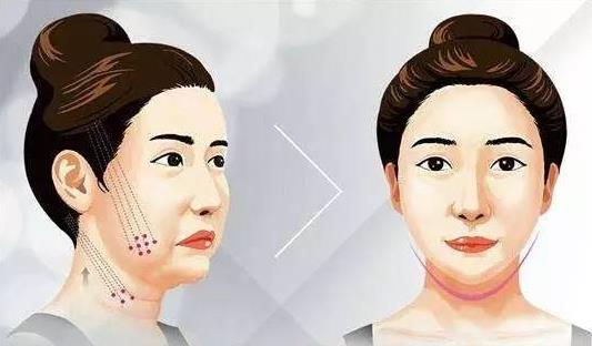 超聲炮刀頭和炮頭的發(fā)數(shù)區(qū)別是什么？