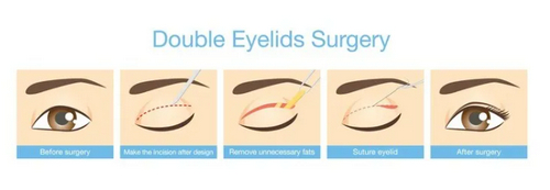 鄭州第一大學(xué)附屬醫(yī)院定點(diǎn)雙眼皮好不好？手術(shù)價(jià)格表+醫(yī)院詳細(xì)介紹