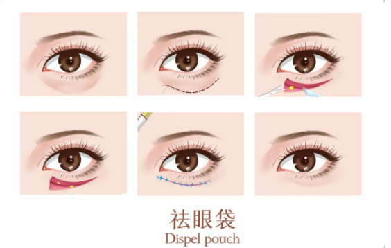 北京藝星醫(yī)療美容_微信截圖_20230220145228.png 北京藝星醫(yī)療美容_微信截圖_20230220145228.png