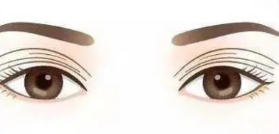 雙眼皮13.png 雙眼皮13.png