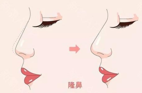 隨州市中心醫(yī)院隆鼻多少錢？科室介紹+價格表