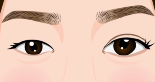 咸寧奧萊醫(yī)院整形科割雙眼皮價格？詳細介紹