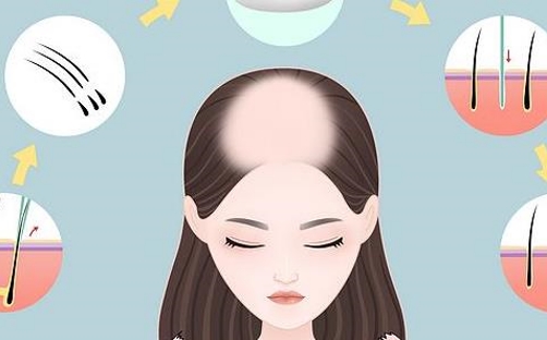 漢大治美尚美醫(yī)療美容醫(yī)院植發(fā)多少錢？過程分享