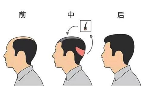 棗陽市人民醫(yī)院燒傷整形外科怎么樣？真實(shí)講解