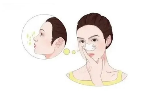 中山市整形科假體隆鼻多少錢？醫(yī)院介紹+隆鼻案例分享