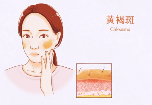 周口中心醫(yī)院美容祛斑怎么樣？祛斑案例效果反饋附上提前了解