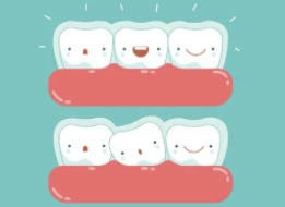 牙齒矯正7.png 牙齒矯正7.png