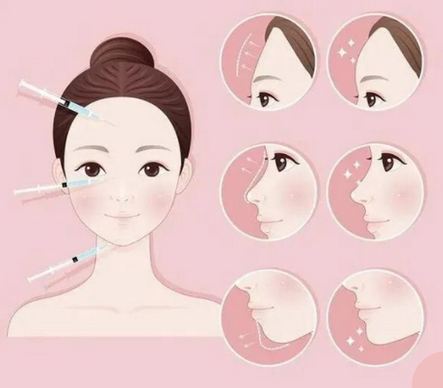 武漢美基元做脂肪填充怎么樣？口碑度高，寶藏醫(yī)院助你變美