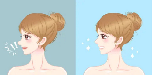 金華做鼻子大概多少錢？費(fèi)用詳情+前三名精選醫(yī)院