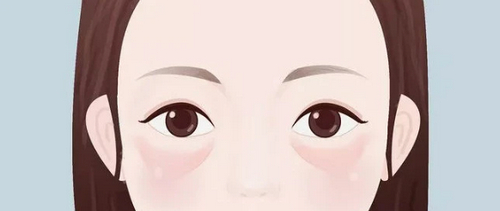 成都華美紫馨外切祛眼袋怎么樣？術(shù)后效果\醫(yī)院環(huán)境點(diǎn)擊查看